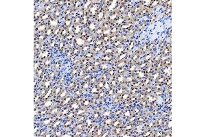IHC analysis of SF3A1 using anti-SF3A1 antibody (ABIN7600556). (SF3A1 抗体  (AA 20-556))
