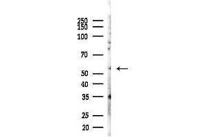 anti-URI1, Prefoldin-Like Chaperone (URI1) (Internal Region) antibody