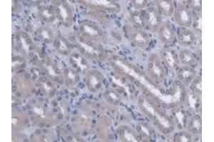 DAB staining on IHC-P; Samples: Rat Kidney Tissue (OSTM1 抗体  (AA 124-277))