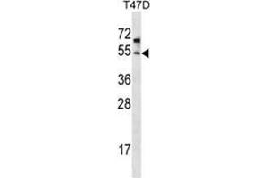 ZDHHC6 Antibody (C-term) western blot analysis in T47D cell line lysates (35 µg/lane). (ZDHHC6 抗体  (C-Term))