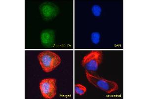 ABIN184562 Immunofluorescence analysis of paraformaldehyde fixed U2OS cells, permeabilized with 0. (BCL7A 抗体  (C-Term))