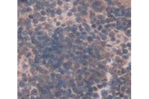 Used in DAB staining on fromalin fixed paraffin- embedded Kidney tissue (Osteocrin 抗体  (AA 26-130))
