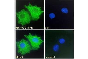ABIN334381 Immunofluorescence analysis of paraformaldehyde fixed HepG2 cells, permeabilized with 0.
