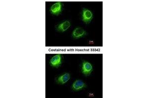 Immunofluorescence (IF) image for anti-Inositol Polyphosphate-5-Phosphatase F (INPP5F) antibody (ABIN2855799)
