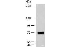 Western blot analysis of Human fetal brain tissue lysate using PPEF1 Polyclonal Antibody at dilution of 1:1500 (PPEF1 抗体)