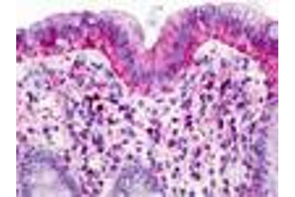 GPR160 抗体  (Transmembrane Domain)