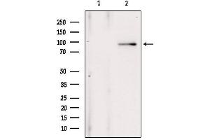 Western blot analysis of extracts from 293, using ANO1 Antibody. (ANO1 抗体  (Internal Region))