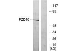 Western blot analysis of extracts from COS7 cells, using FZD10 Antibody. (FZD10 抗体  (AA 135-184))