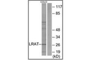 Western blot analysis of extracts from COLO205 cells, using LRAT Antibody . (LRAT 抗体  (Internal Region))