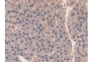 Detection of MK in Mouse Liver Tissue using Polyclonal Antibody to Midkine (MK)
