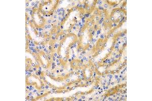 Immunohistochemistry (Paraffin-embedded Sections) (IHC (p)) image for anti-Breast Carcinoma Amplified Sequence 3 (BCAS3) (AA 674-913) antibody (ABIN6137481)