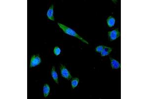 IF analysis of P Glycoprotein using anti-P Glycoprotein antibody (ABIN5693064).
