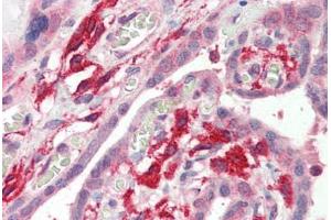 Human Placenta (formalin-fixed, paraffin-embedded) stained with AIF1 antibody ABIN337130 at 2. (Iba1 抗体  (AA 138-148))