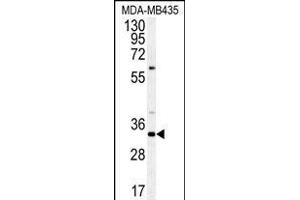 Western blot analysis of SGF29 Antibody (C-term) (ABIN651333 and ABIN2840193) in MDA-M cell line lysates (35 μg/lane). (SGF29 抗体  (C-Term))