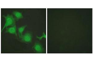Immunofluorescence analysis of HuvEc cells, using NFE2L2 antibody (ABIN5976469). (NRF2 抗体  (C-Term))