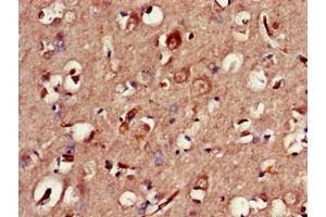Immunohistochemistry of paraffin-embedded human brain tissue using ABIN7147793 at dilution of 1:100 (CLOCK 抗体  (AA 577-846))