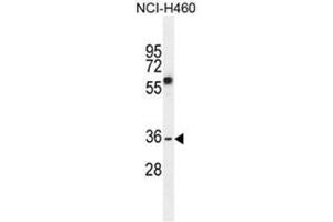 C10orf72 Antibody (Center) western blot analysis in NCI-H460 cell line lysates (35µg/lane). (VSTM4 抗体  (Middle Region))