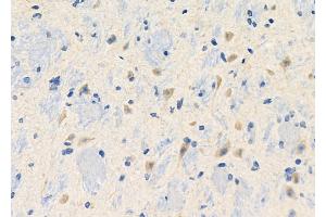 ABIN6260194 and ABIN6272676 at 1/100 staining Mouse brain tissue by IHC-P. (BAI3 抗体  (Internal Region))