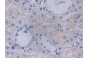 Immunohistochemistry (IHC) image for anti-Tyrosyl-tRNA Synthetase (Yars) (AA 2-528) antibody (ABIN7443434)