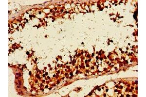 Immunohistochemistry of paraffin-embedded human testis tissue using ABIN7154943 at dilution of 1:100 (HLTF 抗体  (AA 332-476))
