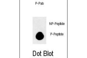 Dot Blot (DB) image for anti-APG8b (pThr93), (pTyr99) antibody (ABIN3001933) (APG8b (pThr93), (pTyr99) 抗体)