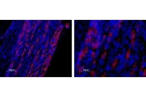Immunohistochemistry (IHC) image for anti-Calcium Channel, Voltage-Dependent, T Type, alpha 1H Subunit (CACNA1H) (AA 581-595), (Intracellular) antibody (ABIN7043010)