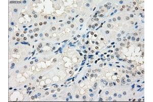 Immunohistochemical staining of paraffin-embedded Kidney tissue using anti-GBP2mouse monoclonal antibody. (GBP2 抗体)