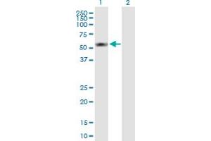 Western Blot analysis of S100PBP expression in transfected 293T cell line by S100PBP MaxPab polyclonal antibody. (S100PBP 抗体  (AA 1-408))