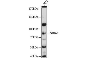 Western blot analysis of extracts of 293T cells, using STR antibody (ABIN6133187, ABIN6148633, ABIN6148634 and ABIN6215704) at 1:3000 dilution. (STRA6 抗体  (AA 538-667))