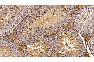 Immunohistochemistry (IHC) image for anti-serpin Peptidase Inhibitor, Clade A (Alpha-1 Antiproteinase, Antitrypsin), Member 1 (SERPINA1) (AA 25-413) antibody (ABIN7429055)