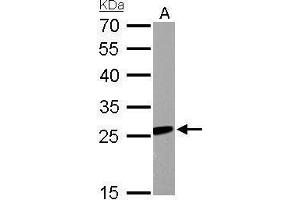WB Image RGS2 antibody detects RGS2 protein by Western blot analysis. (RGS2 抗体)