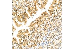 Immunohistochemistry analysis of paraffin-embedded mouse colon using LI Cadherin (ABIN7074493) at dilution of 1: 1500 (LI Cadherin 抗体)