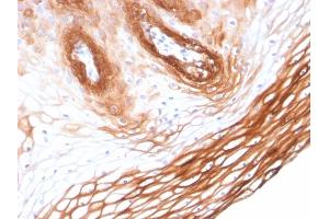 Immunohistochemistry (IHC) image for anti-Keratin 14 (KRT14) (AA 351-472) antibody (ABIN6939908)