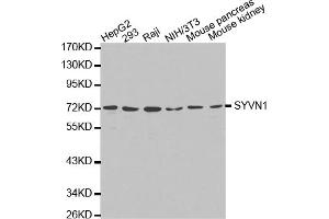 Western blot analysis of extracts of various cell lines, using SYVN1 antibody (ABIN5971424). (SYVN1 抗体)