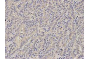 Immunohistochemistry (IHC) image for anti-Lipopolysaccharide-Induced Tumor Necrosis Factor-alpha Factor (LITAF) antibody (ABIN1876657) (LITAF 抗体)