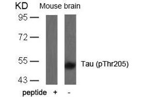 Western blot analysis of extracts from mouse brain tissue using Tau(Phospho-Thr205) Antibody and the same antibody preincubated with blocking peptide. (MAPT 抗体  (pThr205))