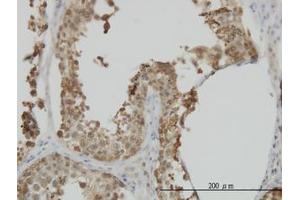 Image no. 3 for anti-Heat Shock 70kDa Protein 1-Like (HSPA1L) (AA 561-642) antibody (ABIN598752) (HSPA1L 抗体  (AA 561-642))