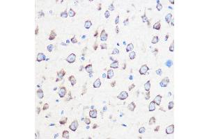 Immunohistochemistry of paraffin-embedded mouse brain using C Rabbit pAb (ABIN7266028) at dilution of 1:100 (40x lens).