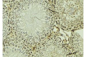 ABIN6274119 at 1/100 staining Mouse testis tissue by IHC-P. (TRIM3 抗体  (Internal Region))