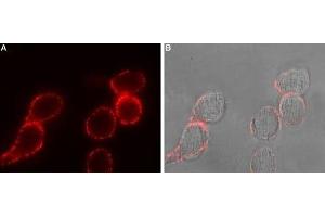 Immunocytochemistry (ICC) image for anti-Adenylate Cyclase 3 (ADCY3) (AA 285-299), (Extracellular) antibody (ABIN7042892)