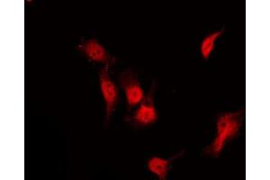 ABIN6267233 staining NIH-3T3 by IF/ICC. (HDAC3 抗体  (pSer424))