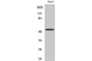 Western Blotting (WB) image for anti-Cytochrome P450, Family 2, Subfamily W, Polypeptide 1 (CYP2W1) (Internal Region) antibody (ABIN3184192) (CYP2W1 抗体  (Internal Region))