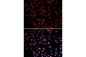 Immunofluorescence (IF) image for anti-Polymerase (DNA Directed), delta 1, Catalytic Subunit 125kDa (POLD1) antibody (ABIN1876511) (POLD1 抗体)