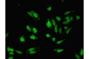 Immunofluorescent analysis of Hela cells using ABIN7155327 at dilution of 1:100 and Alexa Fluor 488-congugated AffiniPure Goat Anti-Rabbit IgG(H+L) (HDAC8 抗体  (AA 1-377))
