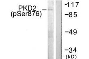 Western blot analysis of extracts from NIH-3T3 cells treated with PMA 250ng/ml 15', using PKD2 (Phospho-Ser876) Antibody. (PKD2 抗体  (pSer876))