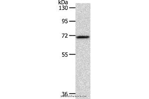 Western blot analysis of Mouse liver tissue, using SOX13 Polyclonal Antibody at dilution of 1:800 (SOX13 抗体)