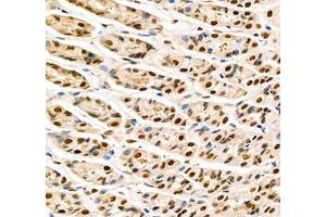 Immunohistochemistry (Paraffin-embedded Sections) (IHC (p)) image for anti-Transketolase (TKT) antibody (ABIN7075978)