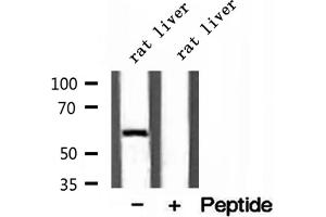 Western blot analysis of extracts of rat liver tissue, using D2HGDH antibody. (D2HGDH 抗体  (C-Term))