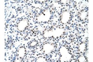 THOC1 antibody was used for immunohistochemistry at a concentration of 4-8 ug/ml to stain Alveolar cells (arrows) in Human Lung. (THOC1 抗体  (C-Term))