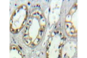 IHC-P analysis of Kidney tissue, with DAB staining. (ITGAD 抗体  (AA 886-1106))